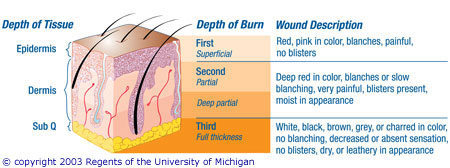 American Burn Association Criteria For Transfer American Burn Association Criteria For Transfer